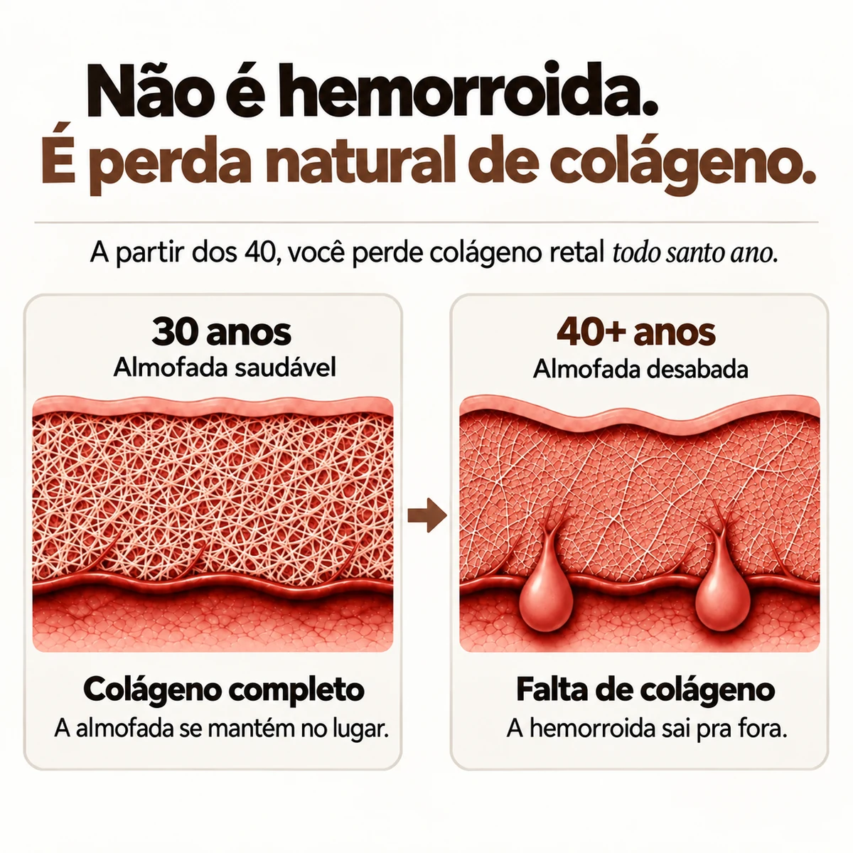 Venalys™ Cápsulas de Suporte à Almofada de Colágeno